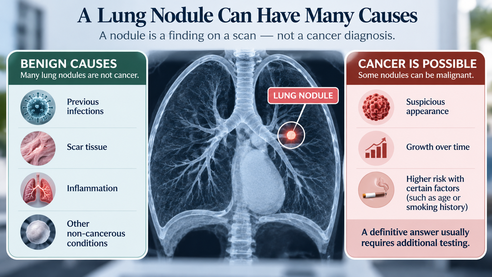 Medical infographic explaining that a lung nodule is an imaging finding that can have benign or malignant causes