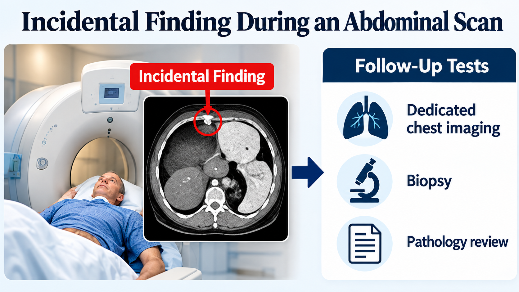 Diagram showing how an unrelated abdominal scan can incidentally reveal a small growth near the bottom of a lung